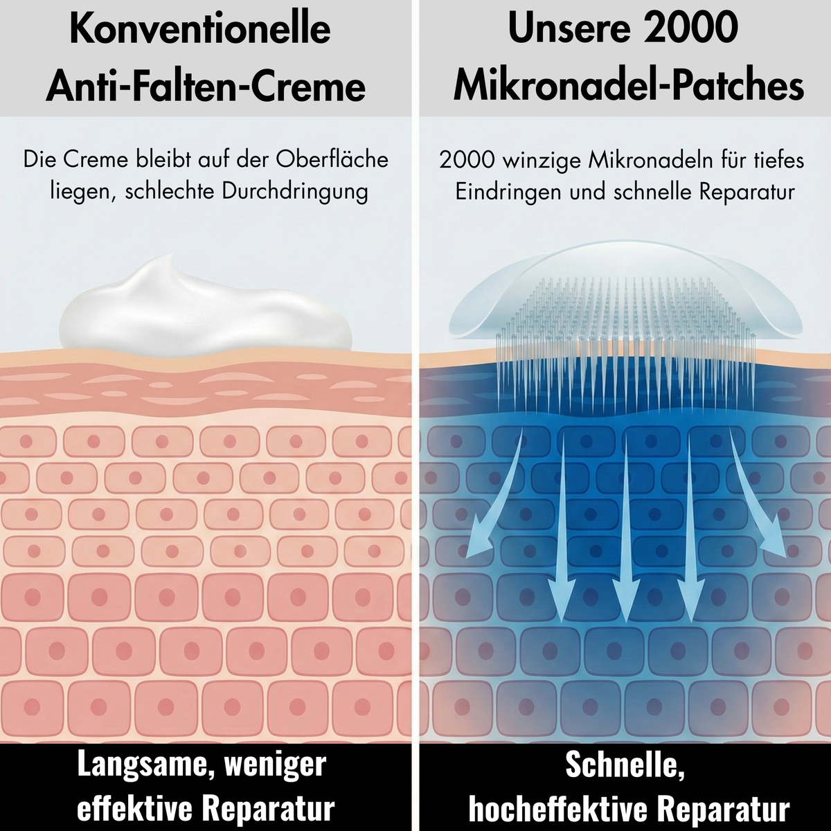 Mikronadel Augenpads