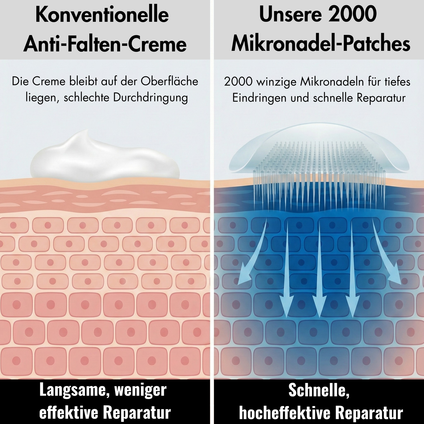 Mikronadel Augenpads