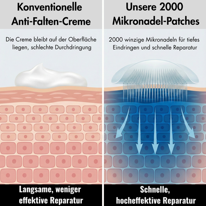 Mikronadel Augenpads